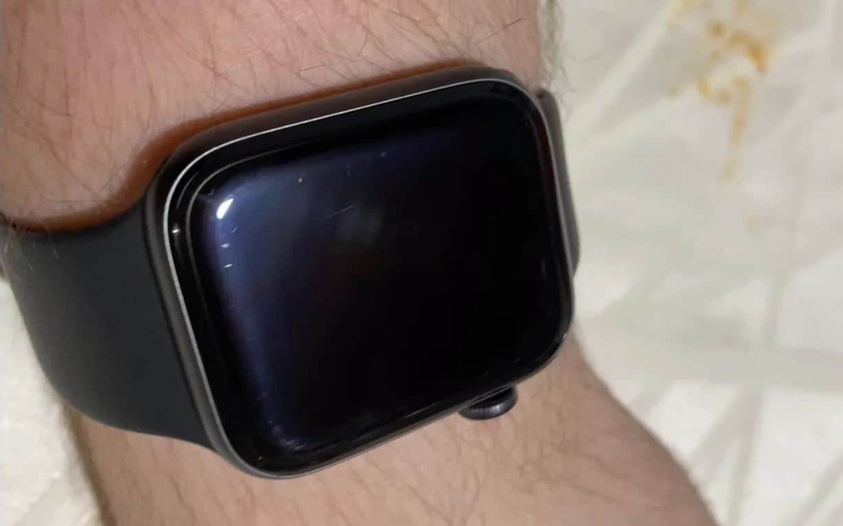 How To Get Rid Of Scratches On Apple Watch